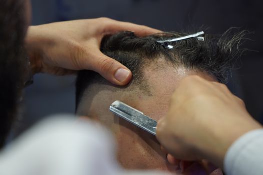 Resultados exitosos de injerto capilar en pacientes en México