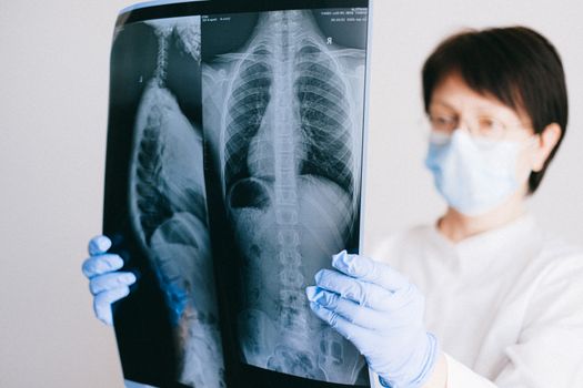 Medicamentos utilizados en el tratamiento de la fibrosis quística