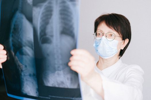 Muestra de esputo para análisis en diagnóstico de fibrosis quística