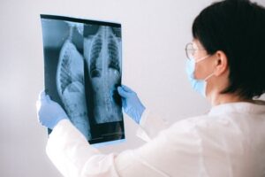 Lee más sobre el artículo Fibrosis quística: Guía completa sobre diagnóstico y tratamiento
